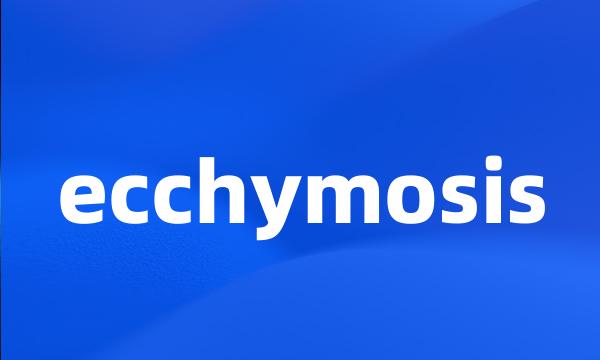 ecchymosis