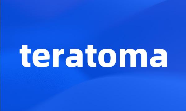 teratoma